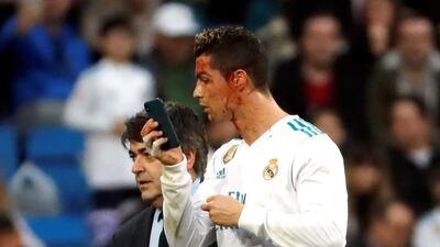 Real Madrid's Portuguese striker Cristiano Ronaldo uses a cellphone to check a wound in his face. Juan Carlos Hidalgo / EPA