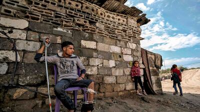 Murad al-Wadyah, a Palestinian youth who was previously injured in a prior demonstration, leans on a crutch as he sits on a chair by his home in Gaza City. AFP