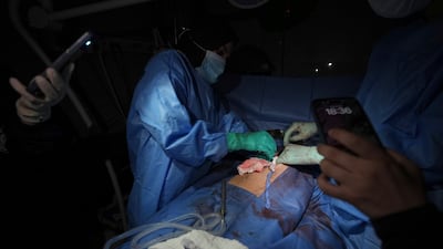 Dr Abeer Al Gharbawi performs surgery illuminated by the flashlights of two cellphones during a power cut at Al Shifa Hospital in Gaza city. All photos: AP