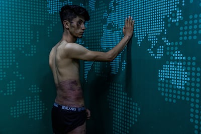 Taqi Daryabi, 22, a video journalist with the 'EtilaatRoz' newspaper, was beaten by the Taliban at a police station on Wednesday after being detained while covering a women's rights protest.