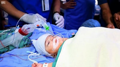 Dr Alrabeeah announces successful separation of Libyan conjoined twins. Courtesy: SPA