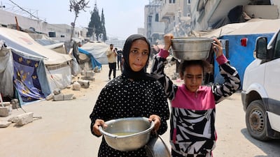 Aid groups warned of surging numbers of malnourished children in war-ravaged Gaza. AFP