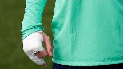 Real Madrid's Gareth Bale's right hand is bandaged as he takes part in the session at the team's Valdebebas training ground in Madrid. AP