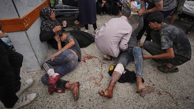 Palestinians are brought to Al Shifa Hospital after being wounded while on their way to an aid distribution centre in Gaza city