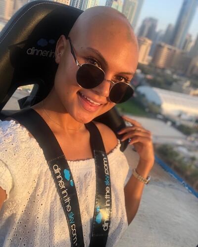 Taylor has suffered with alopecia since she was 15. Yasmin Taylor / Instagram