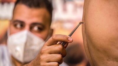 Sayed Al Sayeh clasps with tongs a bee stinging a patient at his Giza practice. AFP