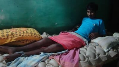 Twenty-year-old S Shoban Babu has spent most of the past year lying in a dim room, recovering from traumatic paraplegia.