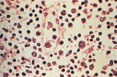 There is no cure for hantavirus but patients can be treated depending on the symptoms. AFP