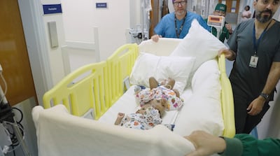 The twin girls were separated after cutting-edge surgeries involving a global team of doctors. Photo: Abu Dhabi Media Office