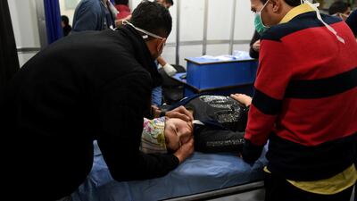 A woman lies on a stretcher inside a hospital after what Syrian state media said was a suspected toxic gas attack in Aleppo. Sana