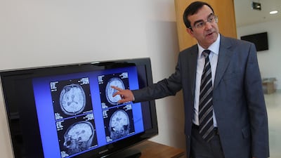 A Neurosurgeon looks at the MRI results of stem cell treatments for a stroke patient in Dubai. Amy Leang / The National