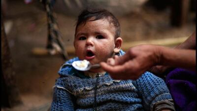 An elderly Palestinian refugee woman feeds a baby suffering from heat rash in a house in Gezirat al-Fadel village.