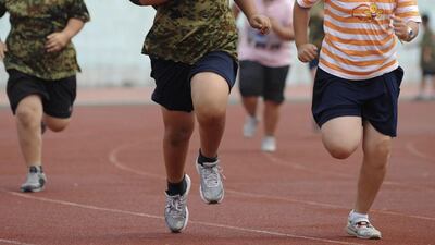 Children exercise during a weight-losing summer camp in Shenyang, China. Sheng Li / Reuters
