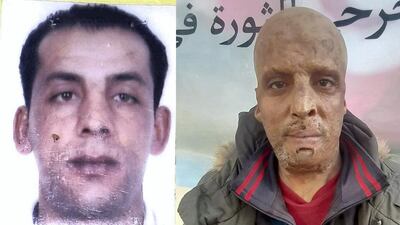 Hosni Qelieh has sustained third-degree burns that scarred his face and most of his body when he decided to commit suicide by fire in protest at police abuse.