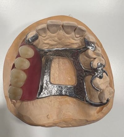 The device simulates lost tissue and teeth around the mouth. Photo: Medcare Dentofaces