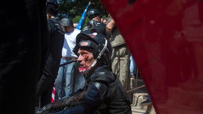 An injured man sits on the ground during the rally. Shaban Athuman / Richmond Times.