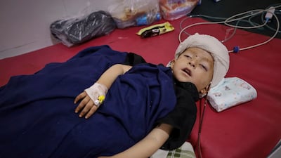 A boy injured during Sunday's earthquake lies in a hospital bed in Jalalabad. AP