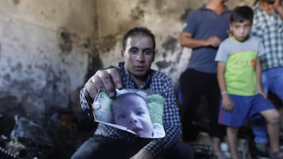 A relative holds up a photo of 18-months-old Ali Dawabshe, who was killed in the firebomb attack in the West Bank village of Duma on July 31, 2015. Majdi Mohammed/AP Photo