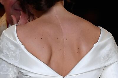 The scar on the back of Britain's Princess Eugenie of York is clearly visible as she arrives for her wedding AFP
