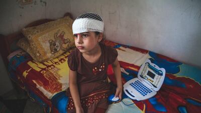 Bisan Daher, 8, lost her parents and four brothers and sisters when an Israeli F16 jet bombed their home during the summer 50-day war on Gaza. As her physical injuries begin to heal, the psychological damage is starting to emerge. Andrea DiCenzo for The National