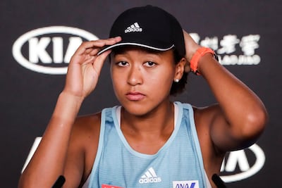 The spotlight is on Naomi Osaka, and she may struggle with that at Melbourne Park this year. Mast Irham / EPA