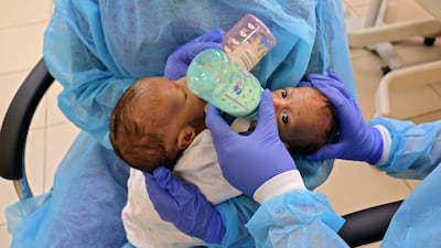 A picture taken on February 2, 2021 shows conjoined twins Mohamed and Ahmed with their nurses at the Specialty Hospital in the Jordanian capital Amman. - Conjoined twin Yemeni boys, who were successfully separated in surgery in Jordan, have returned to the capital Sanaa, the UN children's agency said today. (Photo by Fuad MOOHIALDIN / UNICEF / AFP) / RESTRICTED TO EDITORIAL USE - MANDATORY CREDIT "AFP PHOTO / UNICEF " - NO MARKETING - NO ADVERTISING CAMPAIGNS - DISTRIBUTED AS A SERVICE TO CLIENTS