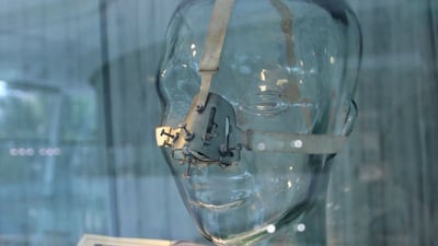 A nose shaper was used by surgeons in the early 1900s before the development of cosmetic surgery. The device used screws to alter bone structure