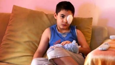 Yousef ben Lafi, 6, at his home in Ajman after his left eye was damaged when hand sanitiser squirted into it. Pawan Singh / The National