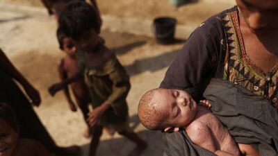 A Rohingya woman shows her baby, who is suffering from a skin infection, at the Thet Kae Pyin camp for internally displaced people in Sittwe.