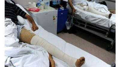 Syrian patients are being treated in a hospital in the south-eastern Turkish city of Hatay. Mustafa Ozer / AFP