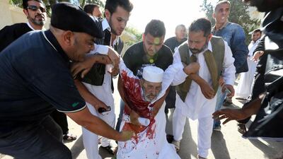 People assist a man who was injured after Libyan militiamen opened fire on a crowd wanting them to move out of their headquarters on Friday. AFP