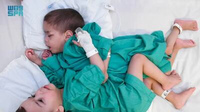 The twins arrived in Riyadh in May, on-board a medical evacuation flight from Ankara. SPA