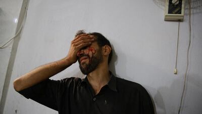 A wounded man at a makeshift hospital in the rebel-held area of Douma, east of Damascus, following Syrian regime air strikes on August 12, 2015, that killed at least 27 civilians. Abd Doumany / AFP