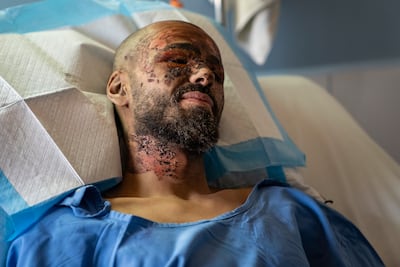 Amir Nemer was injured in an Israeli strike on the Gouraud Barracks. Matt Kynaston / The National