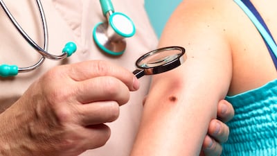 Moderna CEO says the personalised melanoma vaccine could be approved as soon as 2027. Getty Images