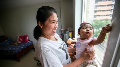 Mrs Carungay took the decision to have the operation for her daughter Aleeyah in Taiwan because it was not possible to schedule one earlier in the Philippines.