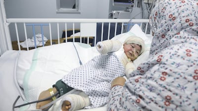 Sheikha Saeed, 2, was badly burned after a pressure cooker exploded in the kitchen of her home. Khushnum Bhandari / The National