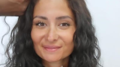 Sarah has her hair cut back during treatment at Cleveland Clinic.