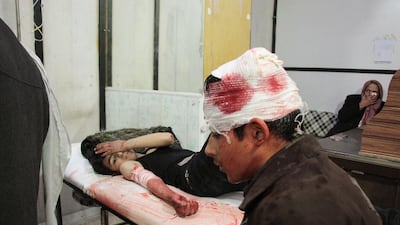 Syrian youths receive treatment at a makeshift clinic following a reported strike by Syrian government forces in the rebel-held town of Douma, in Syria's eastern Ghouta region, on January 2, 2018. / AFP PHOTO / Hamza Al-Ajweh