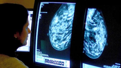 Mammograms are one of the first ways to catch breast cancer. PA