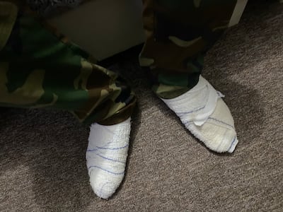 The bandaged feet of Hamed Hakimpour, an Iranian Kurdish member of the armed dissident group Khabat. Mr Hakimpour was injured in a drone strike on a Khabat base in the Kurdistan Region of Iraq, which killed two of his fellow fighters. Lizzie Porter / The National