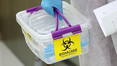 Tests are collected and processed as fast as possible. Chris Whiteoak / The National