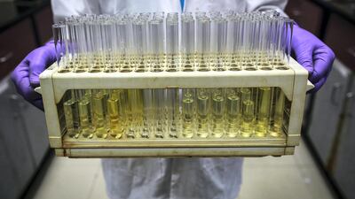 An employee carries test tubes inside a laboratory at Piramal's Research Centre in Mumbai August 11, 2014. Indian drugmakers are fleeing a regulatory morass at home and moving some research and development to Europe and the United States as they try to boost margins by producing high-value drugs. Companies like Piramal Enterprises Ltd, Sun Pharmaceutical Industries Ltd and Lupin Ltd are investing millions of dollars and placing their future growth in foreign regulators' hands, as they seek to add more complex drugs to their product lines. Picture taken August 11, 2014. To match INDIA-PHARMACEUTICALS/RESEARCH/ REUTERS/Danish Siddiqui (INDIA - Tags: HEALTH BUSINESS DRUGS SOCIETY SCIENCE TECHNOLOGY) - GM1EA8T0EJ601