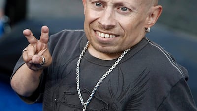 Verne Troyer died on Saturday, April 21, 2018. AP