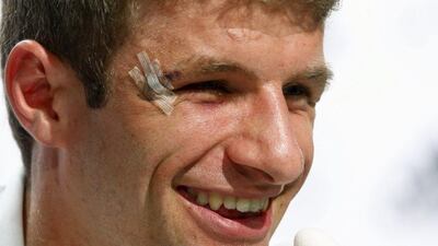 Thomas Muller shown with a cut by his right eye during a press conference on Tuesday ahead of Germany's Thursday match with the United States at the 2014 World Cup in Brazil. Arnd Wiegmann / Reuters / June 24, 2014