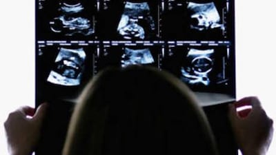 A pregnant woman examines her ultrasound scan at a hospital.