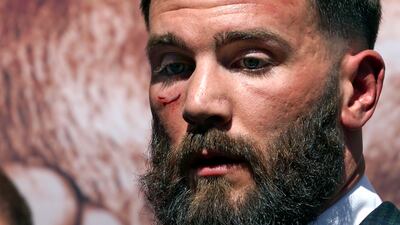 Caleb Plant is seen with a cut under his eye. AP