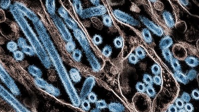 Health experts have been sounding the alarm about the possible pandemic threat posed by H5N1 bird flu. AFP