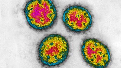 Lassa fever is endemic in West Africa. Alamy