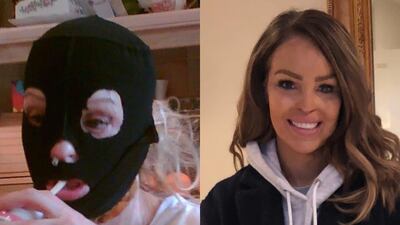 Katie Piper, the survivor of a 2008 acid attack, shared an affecting #10YearChallenge post on her social media platforms. Instagram